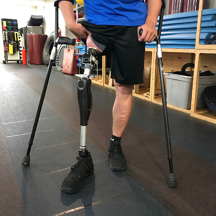 osseointegrated prosthesis