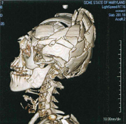 There will be a 3-day Advance Forensic Imaging Course May 9-11 at the Forensic Medicine Center Baltimore, Maryland