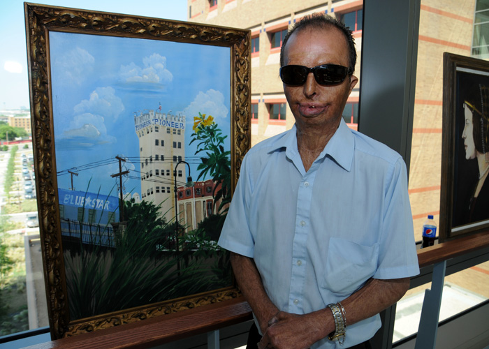 Burn survivor and painter Lupe Munoz displays his artwork
