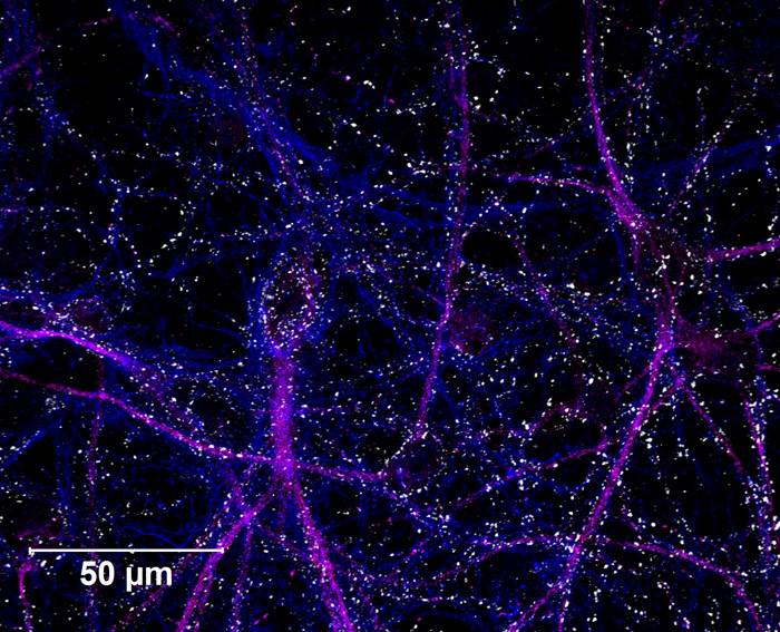 Image of stem cell derived neurons