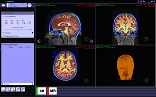 Compiled brain images created through XIP application